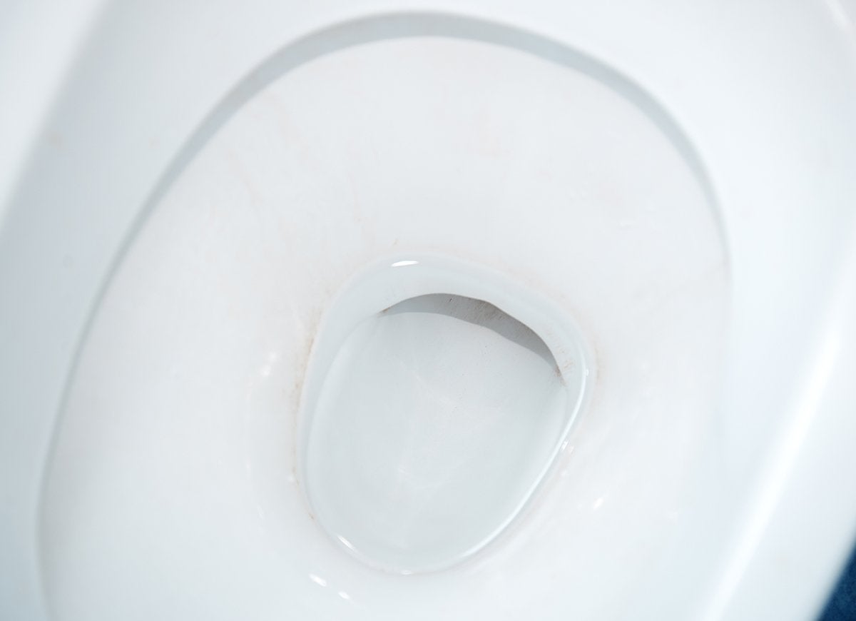 15 Problems Hard Water Can Cause