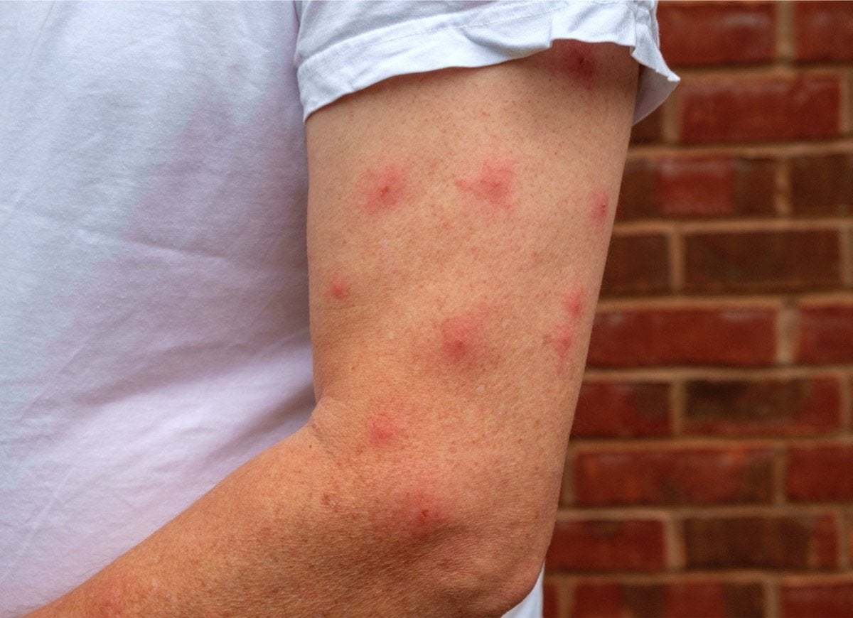 11 Things People Believe About Mosquitoes That Aren’t True