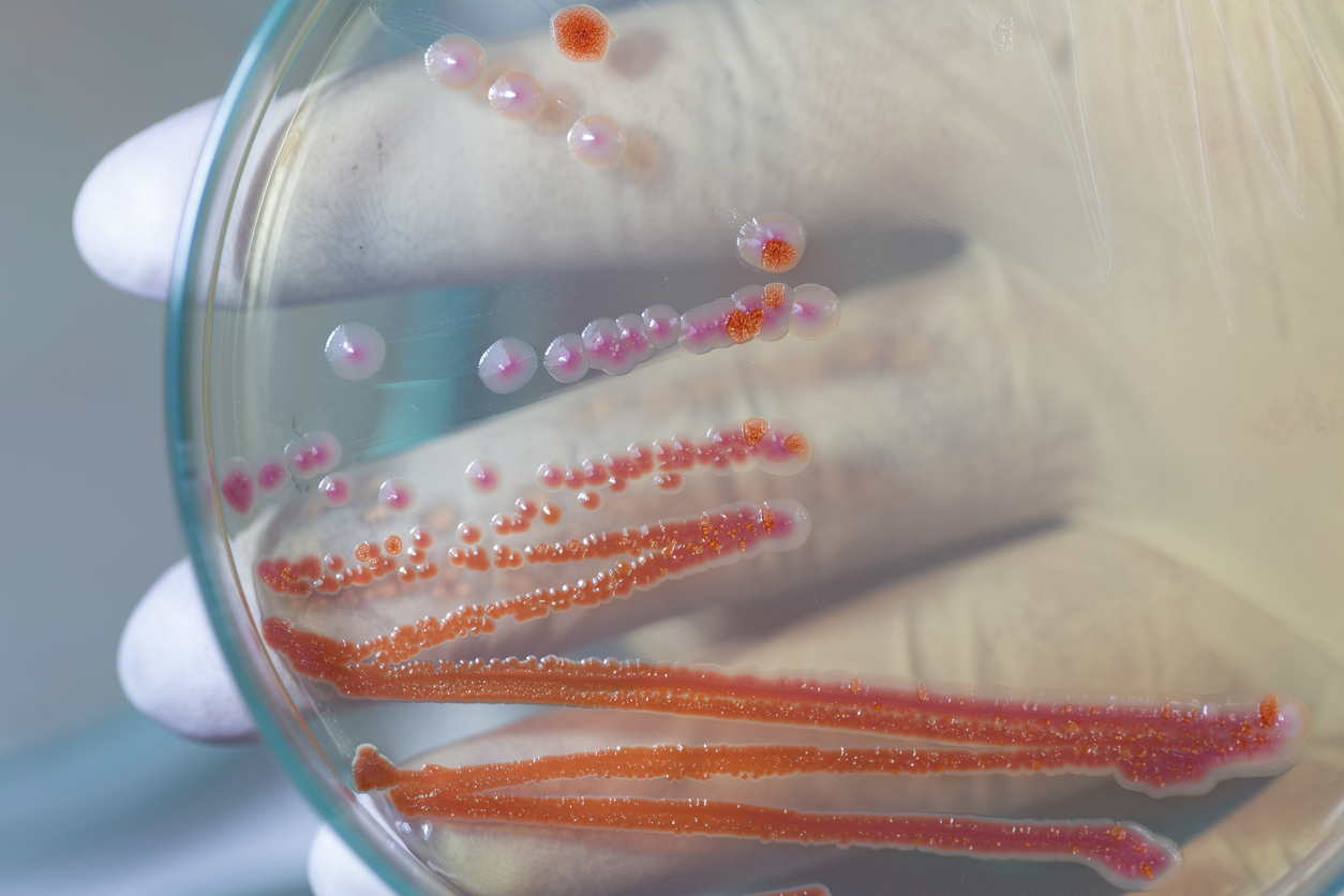 Pink mold growing in a petri dish.