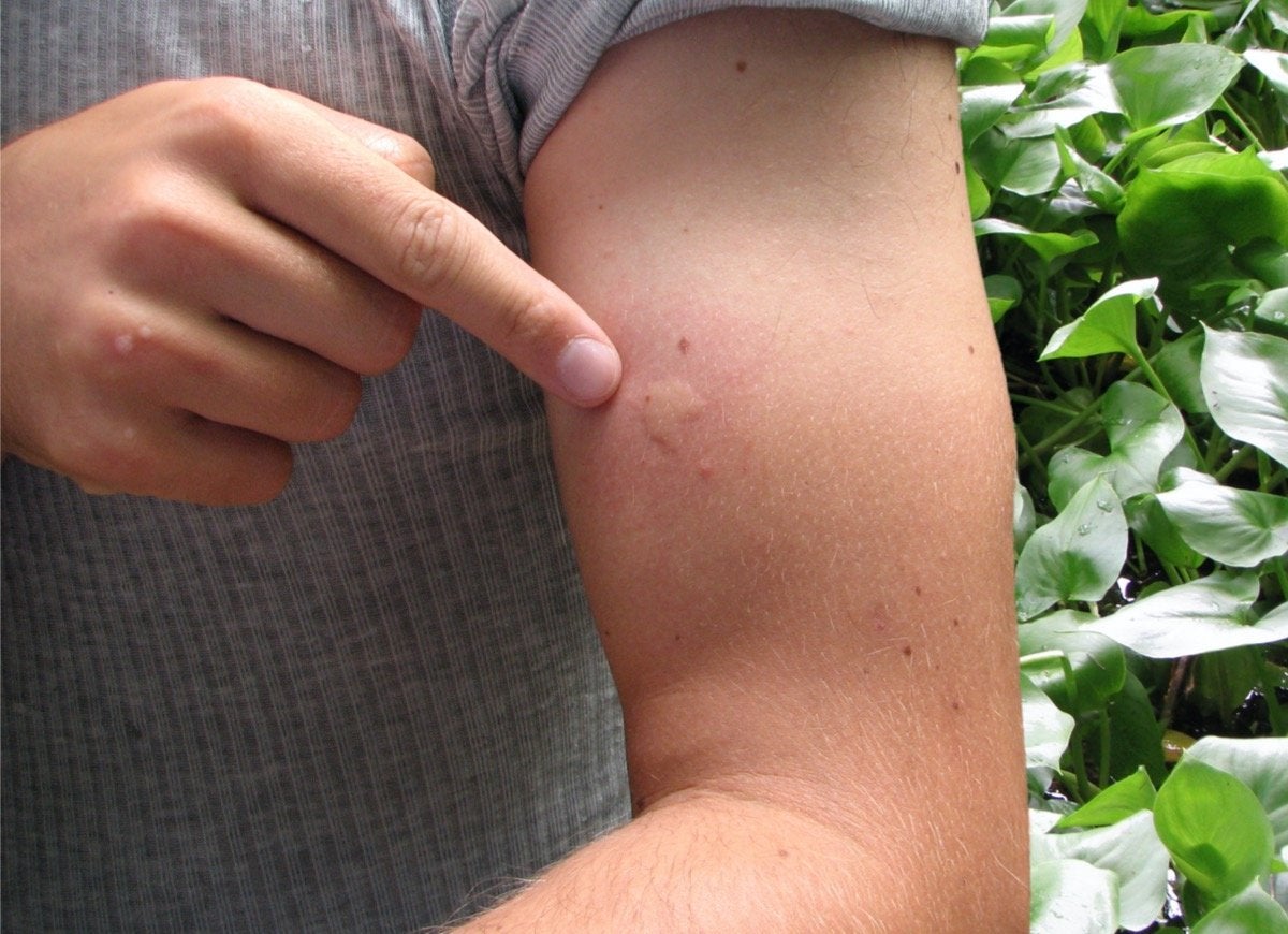 11 Things People Believe About Mosquitoes That Aren’t True