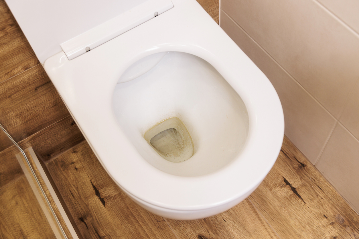 This is an overhead view of a toilet with limescale stains in the bowl.